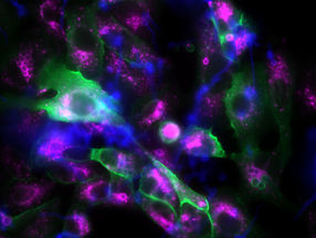 Fungal spores hijack lung cells