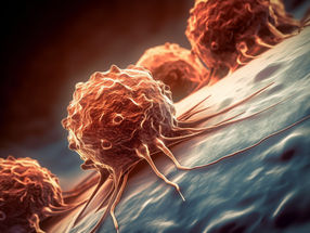 Immune-cell booster for cancer patients