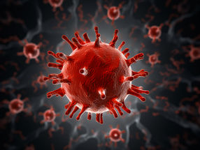 Where the HI-Virus sleeps in the brain
