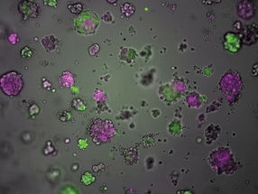 Dietary supplement helps combat resistance in breast cancer