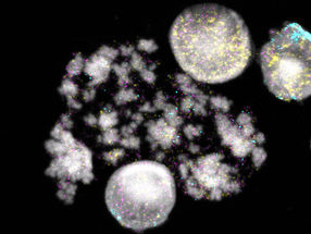 How cancer genes become independent