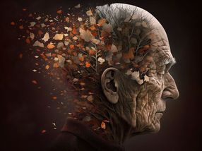 Alzheimer’s: modulation of cell membrane influences formation of amyloid-β
