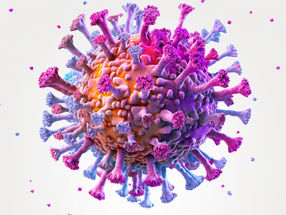 Diagnosis of Type 1 Diabetes After SARS-CoV-2 Infection