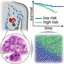 Researchers develop new marker for cancer cell motility