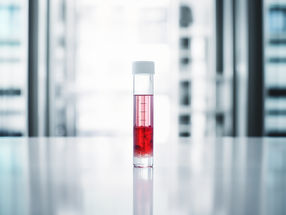 Inflammation Values by Spectrometry