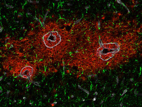 Secretomics uncovers blood-brain barrier mystery