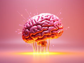 "Anti-obesity drugs" normalises brain in obesity