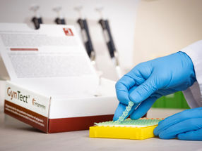 Hong Kong firm invests in Jena-based Oncgnostics GmbH