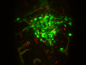 Zebrafish “avatars” to help tailor glioblastoma therapies