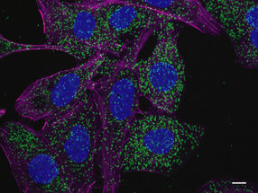 Leukemia cells activate cellular recycling program