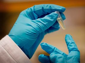 A sugar analysis could reveal different types of cancer