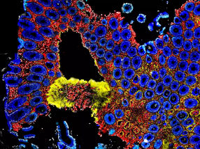 The gut microbiome prevents dangerous immune reactions