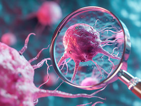 Not all cancers are equal: Getting a Better Look at Tumors