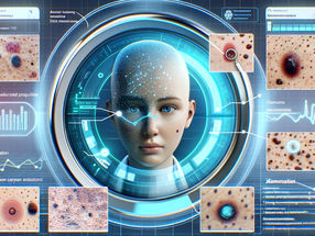 AI-based support system for skin cancer diagnostics explains its decisions