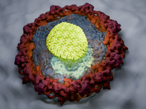 How HIV smuggles its genetic material into the cell nucleus