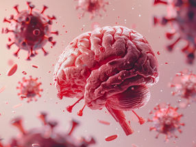 How COVID-19 affects the brain