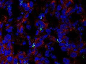 Immune system meets cancer: Checkpoint identified to fight solid tumors