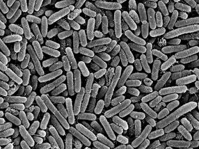 New starting point discovered in the fight against Pseudomonas aeruginosa