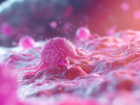 Is there a link between rheumatism and cancer?