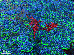 An intestinal chip model takes research of fungal infections to a new level