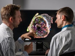 Tumor cells evade the immune system early on