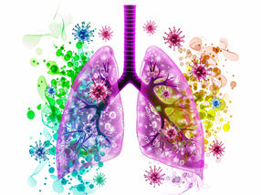 How the immune system learns from harmless particles