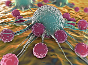 How immune cells recognize the abnormal metabolism of cancer cells