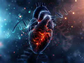 Stroke genetics: independent HTRA1 mechanisms increase risk