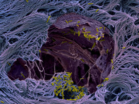 Lung organoids unveil secret: How pathogens infect human lung tissue