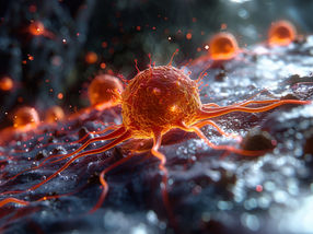 Trigger points for bowel cancer found at a young age
