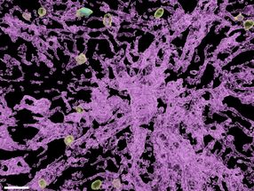 "Sleep timer" for immune cells discovered