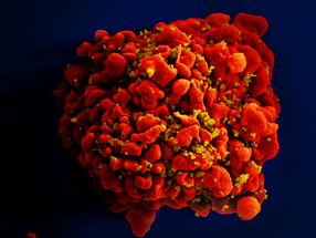 HIV cured at Charité: the next Berlin patient