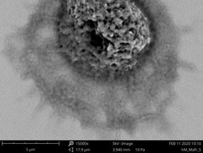 Reckoned without one's host: Transmission of tuberculosis does not only depend on the pathogen