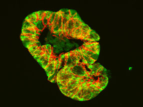 Possible trigger of Crohn’s disease discovered