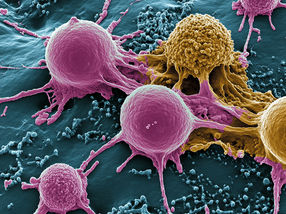A Mushroom for Colorectal Cancer Therapy