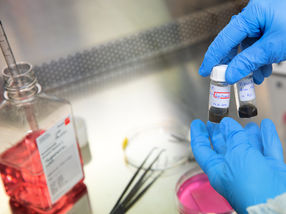 Hope for the treatment of people with severe burns
