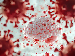 SARS-CoV-2 Spike Protein Accumulation Linked to Long-Lasting Brain Effects