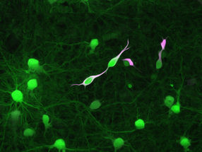 Brain tumour cells rapidly integrate into brain-wide neuronal circuits