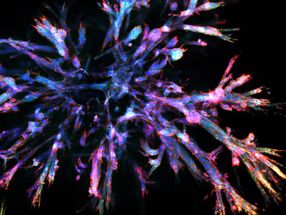 Organoids represent the complex cell landscape of pancreatic cancer