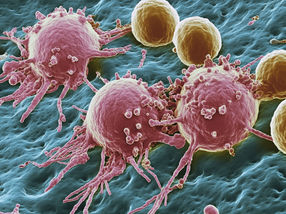 Skin cancer: mode of action of combination immunotherapy decoded