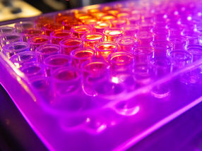 Testing the effect of thousands of compounds on cellular metabolism