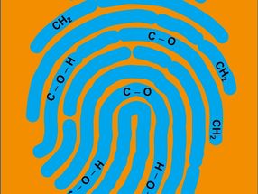 Innovations for Health: When Molecular Spectroscopy Meets Lasers and Photonics