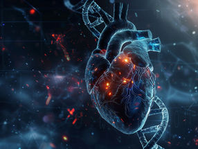 Loss of the Y chromosome discovered as a new risk factor for heart disease