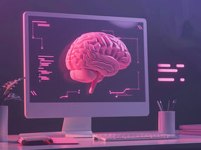 Schizophrenia manifests itself in the brain structure