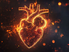 Not all myocarditis is the same