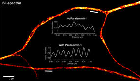 New regulatory protein of the neuronal cytoskeleton identified