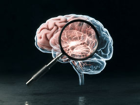 New Body-Fluid Biomarker for Parkinson’s Disease Discovered