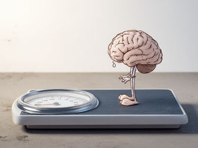 Newly identified group of nerve cells in the brain regulates bodyweight