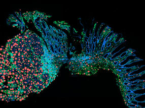 Preventing chronic inflammation from turning into cancer