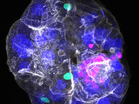 All-in-one model reconstructs complex liver architecture